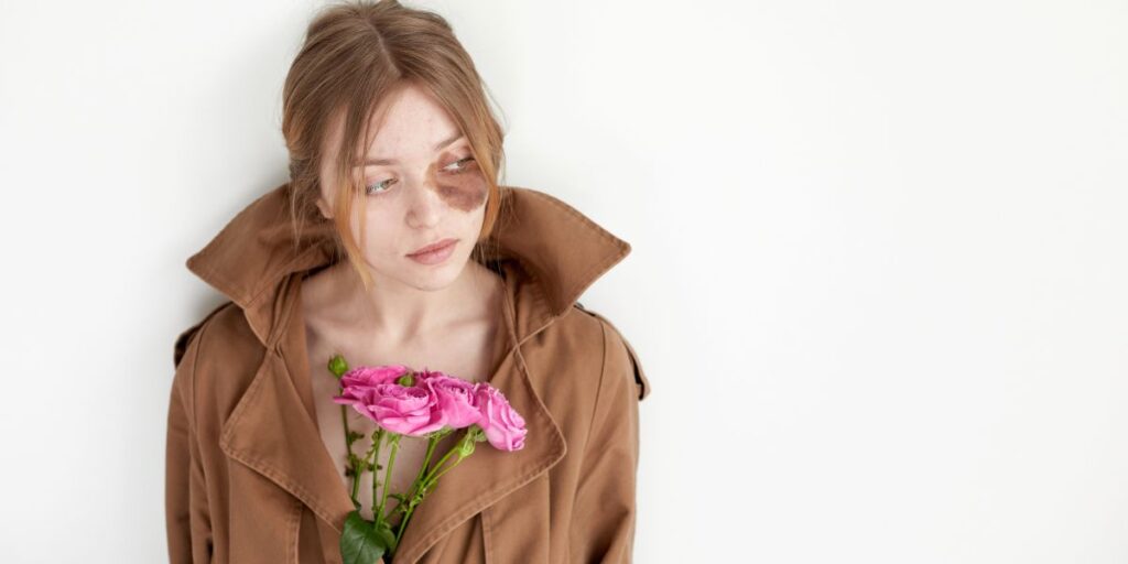 ¿Cómo trato la hiperpigmentación con el cuidado de la piel? - Belleza en verde - bellezaenverde.com