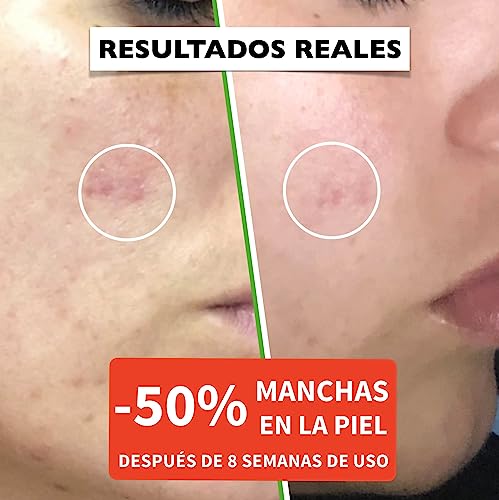 FLORENCE Bio Sérum Facial con Vitamina C, E y Ácido Hialurónico (60 ml)