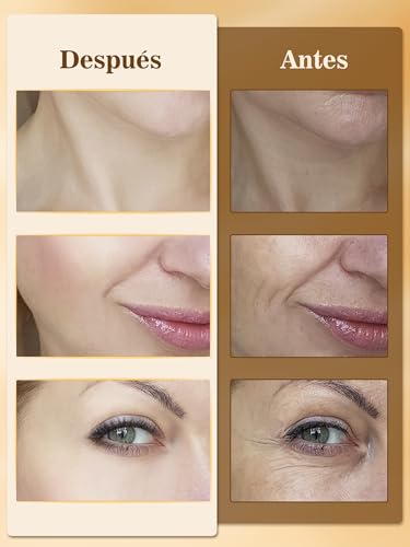 Masajeador Facial Eléctrico con luz 4 Colores LED